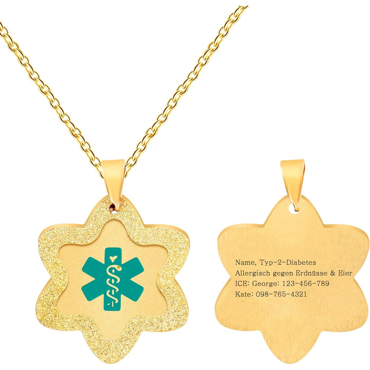Uloveido Medical Alert Necklace for Men & Women, Stainless Steel Star Identification Pendant, Hypoallergenic Waterproof Medical ID Jewelry with Adjustable Chain – YA5503